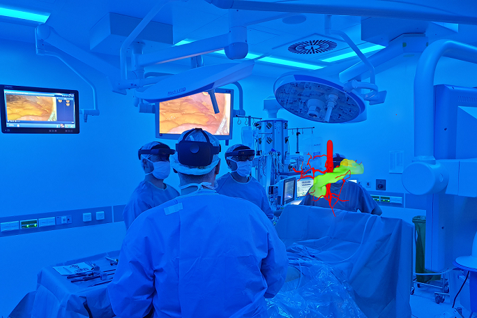 Pankreas als VR-Darstellung im OP-Saal.